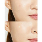 COSRX - Acne Pimple Master Patch 1 sheet